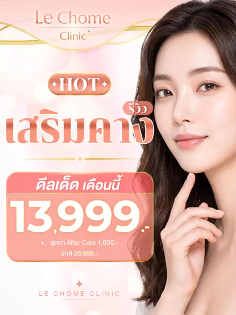 โปรเสริมคาง / เสริมคาง