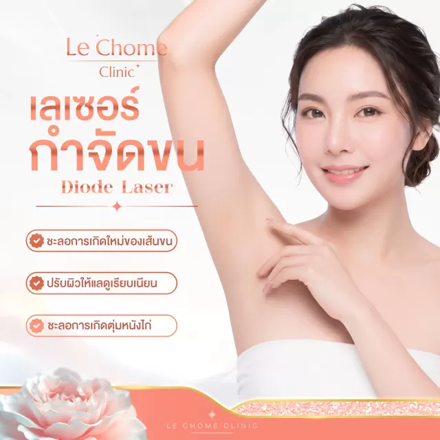 โปรแกรมเลเซอร์กำจัดขน — Diode Laser