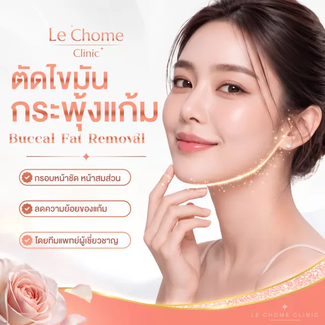 ตัดไขมันกระพุ้งแก้ม — Buccal Fat Removal