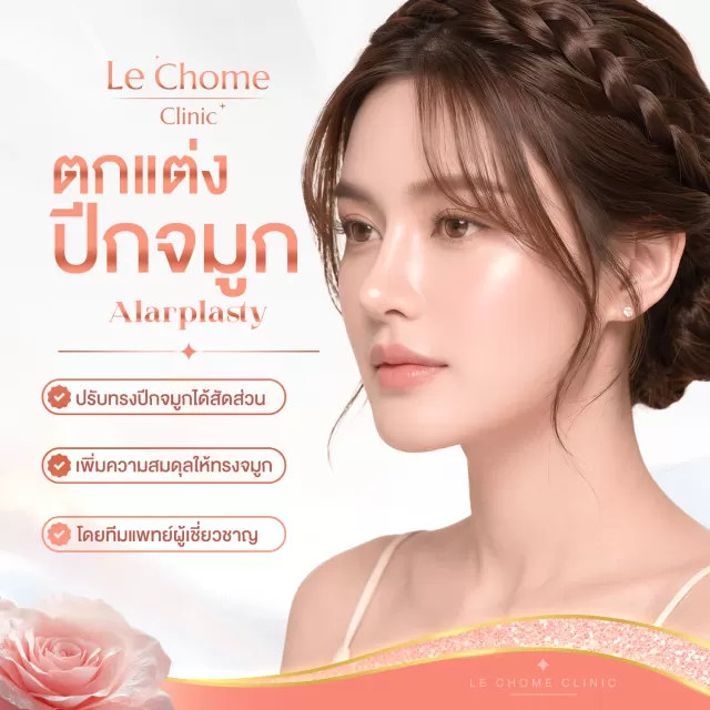 ตกแต่งปีกจมูก — Alarplasty