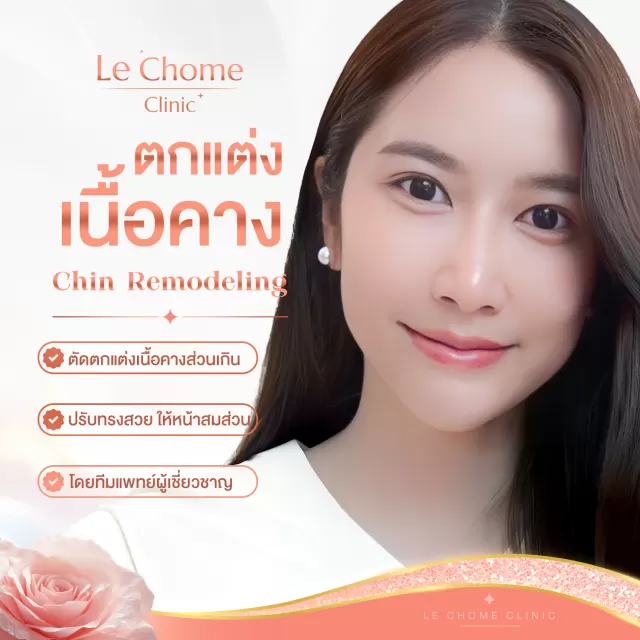 ตัดแต่งเนื้อคาง — Chin Tissue Contouring