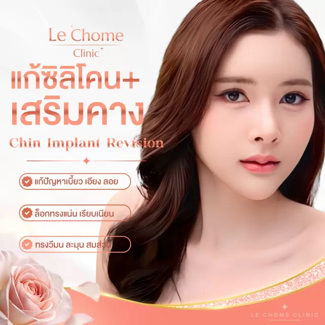 ปรับ/ แก้คาง
