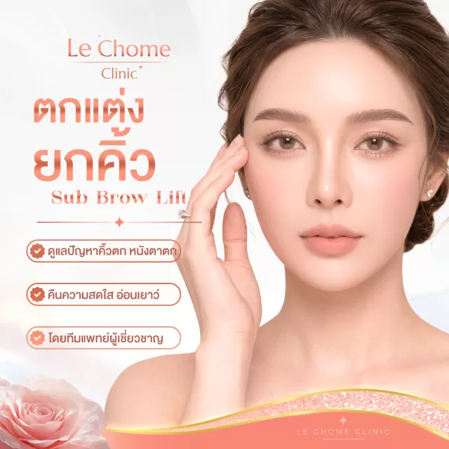ตกแต่งยกกระชับคิ้ว — Sub Brow Lift
