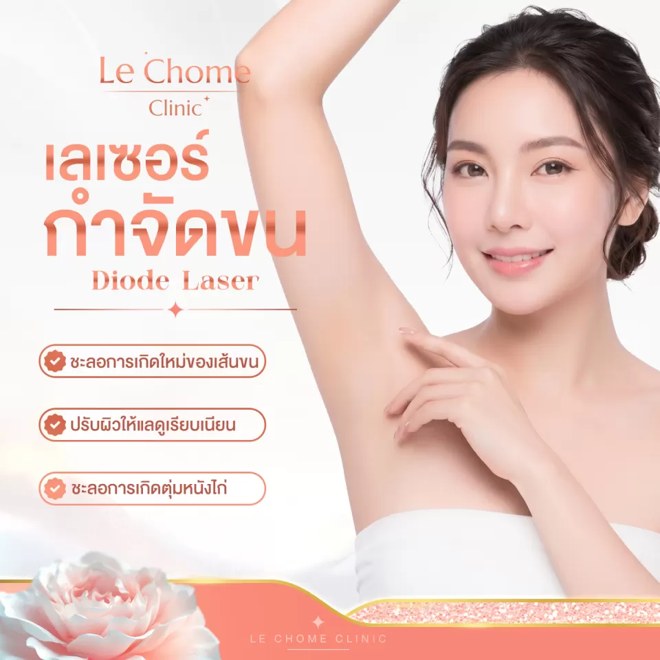 ภาพประกอบบริการโปรแกรมเลเซอร์กำจัดขน ที่ LE CHOME CLINIC