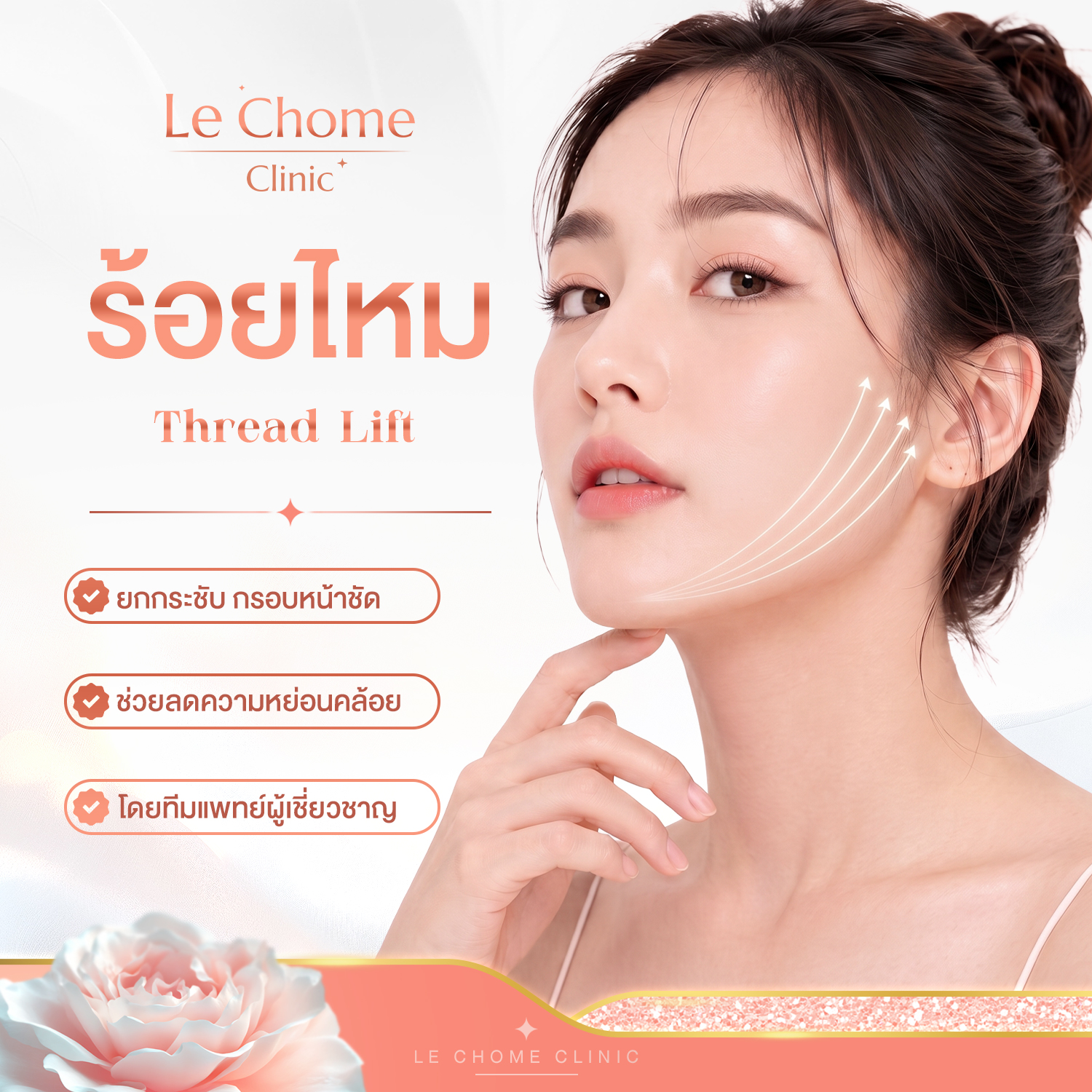 ร้อยไหม — Thread Lift